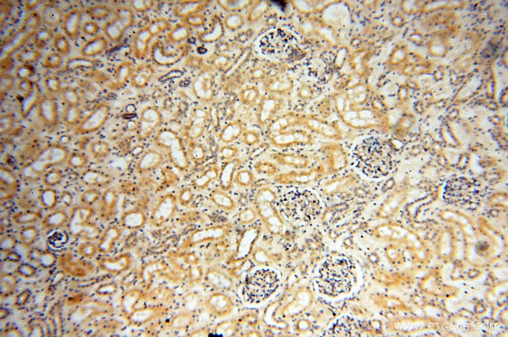 Immunohistochemistry (IHC) staining of human kidney tissue using INPP5E Polyclonal antibody (17797-1-AP)
