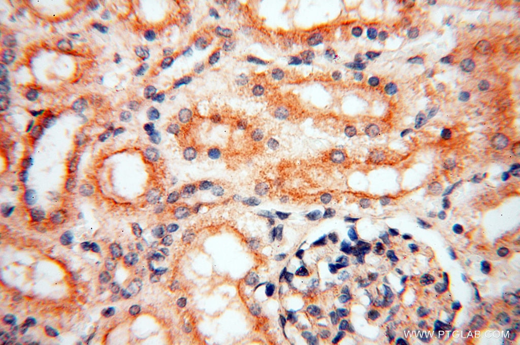 Immunohistochemistry (IHC) staining of human kidney tissue using INPP5E Polyclonal antibody (17797-1-AP)