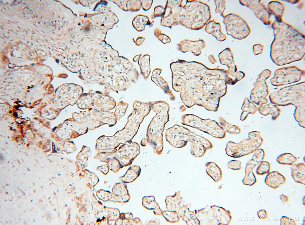 Immunohistochemistry (IHC) staining of human placenta tissue using INPP5E Polyclonal antibody (17797-1-AP)