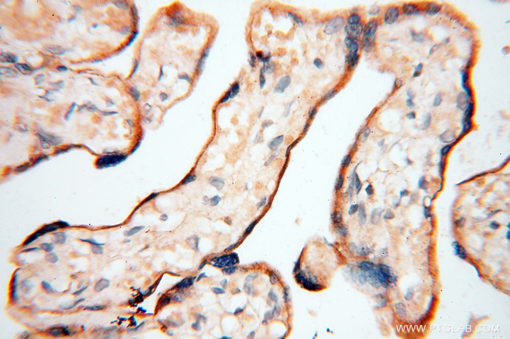 Immunohistochemistry (IHC) staining of human placenta tissue using INPP5E Polyclonal antibody (17797-1-AP)