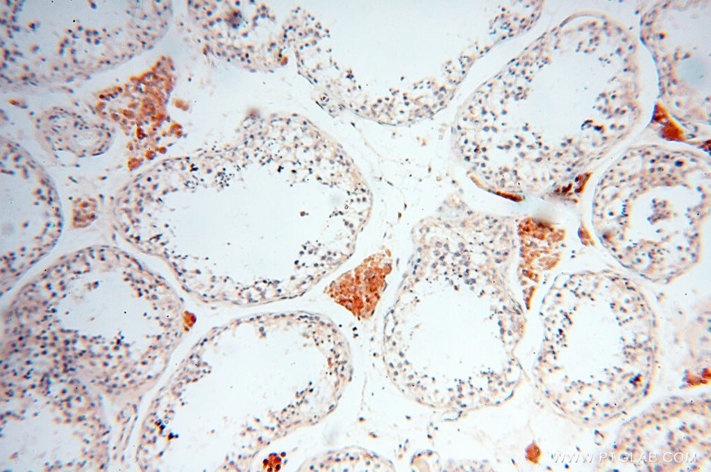 Immunohistochemistry (IHC) staining of human testis tissue using INPP5E Polyclonal antibody (17797-1-AP)