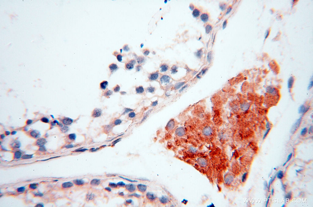 Immunohistochemistry (IHC) staining of human testis tissue using INPP5E Polyclonal antibody (17797-1-AP)