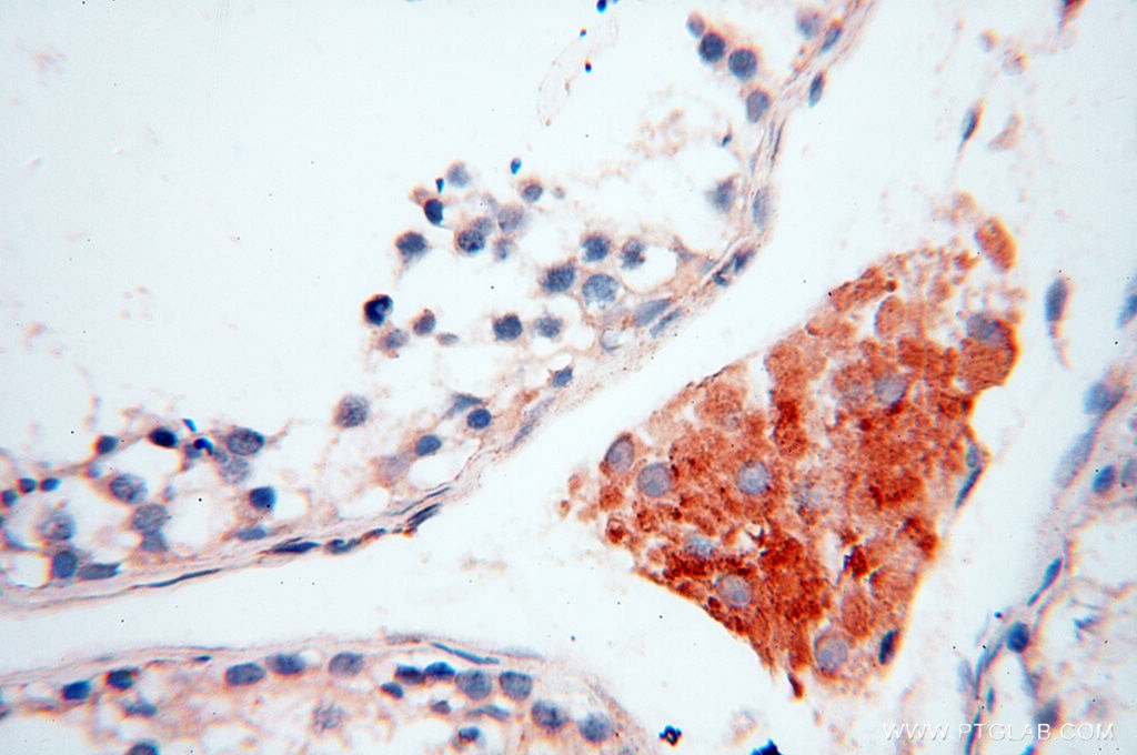 IHC staining of human testis using 17797-1-AP