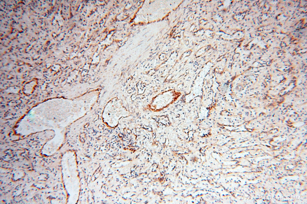 Immunohistochemistry (IHC) staining of human spleen tissue using INPP5E Polyclonal antibody (17797-1-AP)