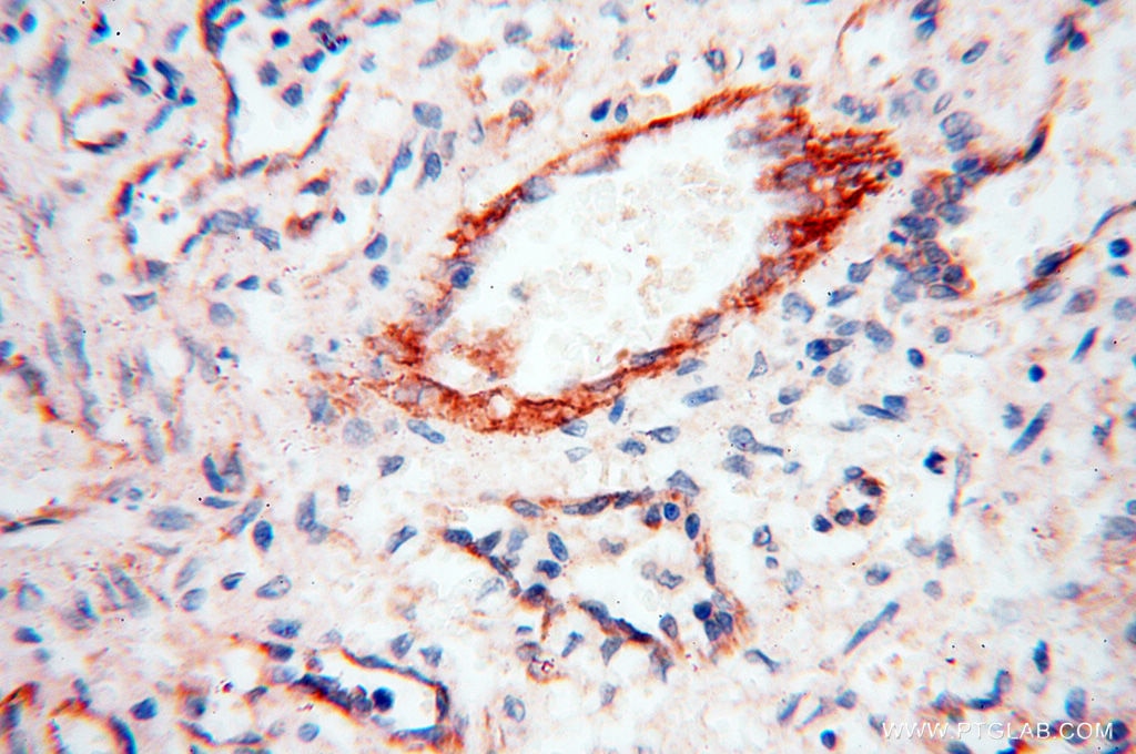 IHC staining of human spleen using 17797-1-AP