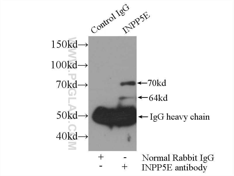 Immunoprecipitation (IP) experiment of HEK-293 cells using INPP5E Polyclonal antibody (17797-1-AP)