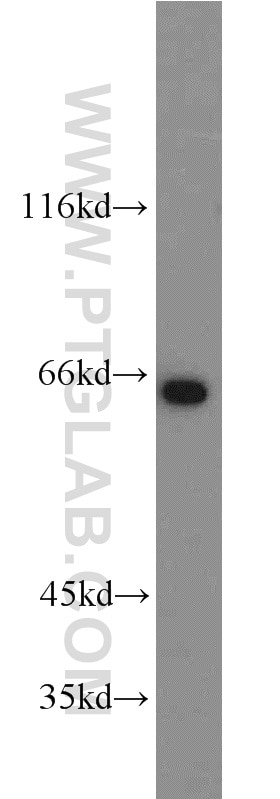 Western Blot (WB) analysis of SH-SY5Y cells using INPP5E Polyclonal antibody (17797-1-AP)