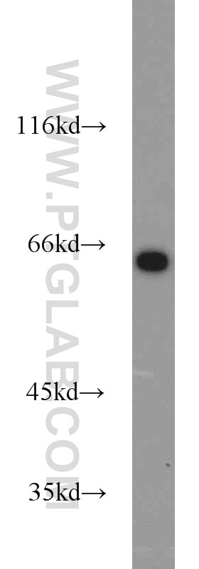 Western Blot (WB) analysis of mouse testis tissue using INPP5E Polyclonal antibody (17797-1-AP)