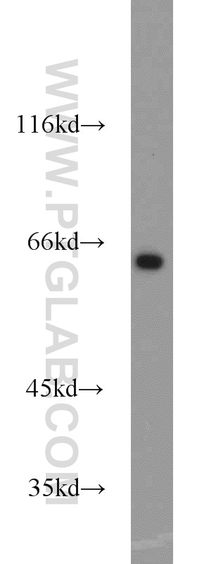 Western Blot (WB) analysis of mouse testis tissue using INPP5E Polyclonal antibody (17797-1-AP)