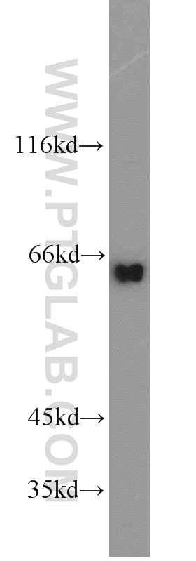 Western Blot (WB) analysis of HEK-293 cells using INPP5E Polyclonal antibody (17797-1-AP)