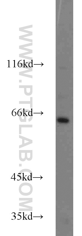 Western Blot (WB) analysis of mouse brain tissue using INPP5E Polyclonal antibody (17797-1-AP)