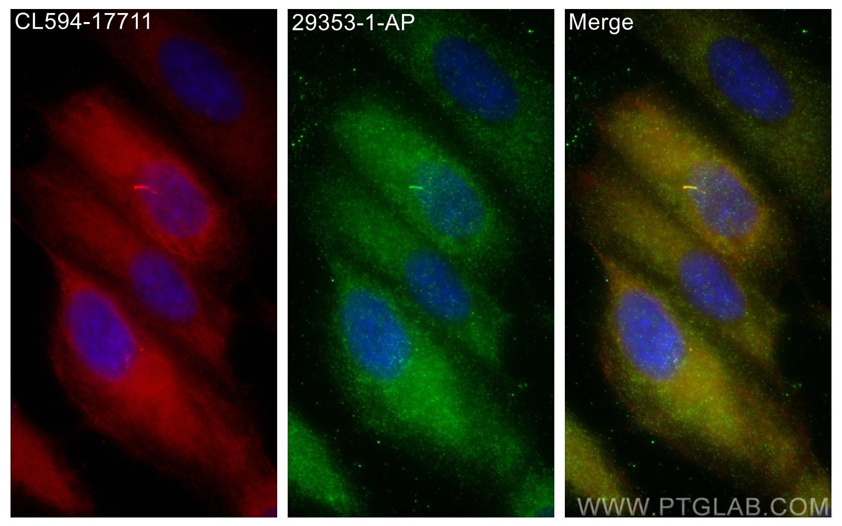 Immunofluorescence (IF) / fluorescent staining of ARPE-19 cells using INPP5E Polyclonal antibody (29353-1-AP)
