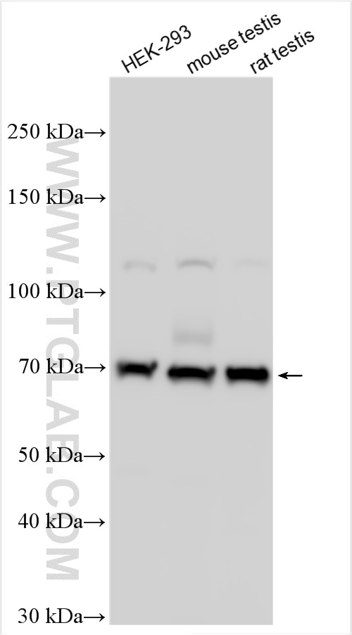 Western Blot (WB) analysis of various lysates using INPP5E Polyclonal antibody (29353-1-AP)