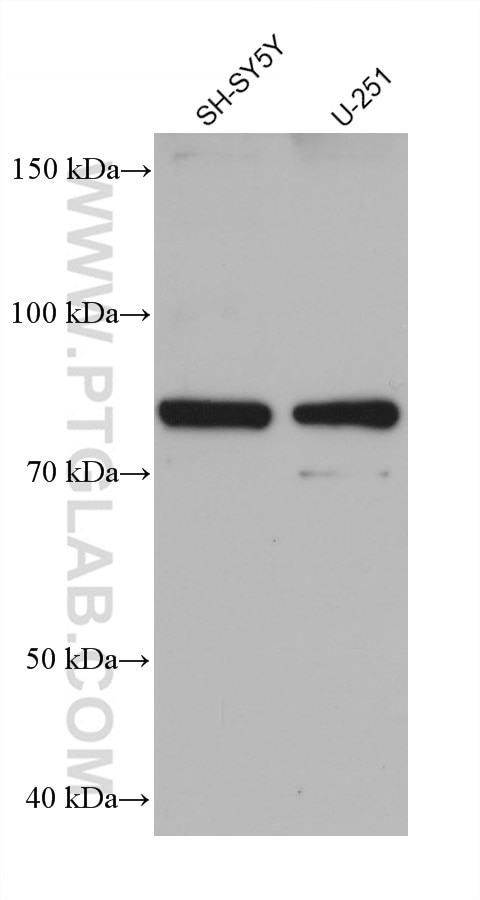 Western Blot (WB) analysis of various lysates using INPP5E Monoclonal antibody (68602-1-Ig)