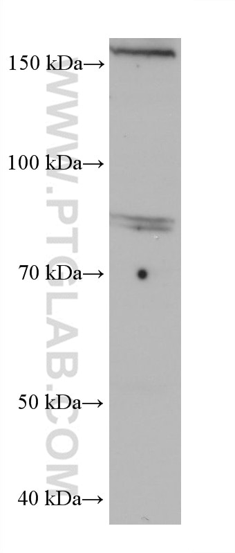 Western Blot (WB) analysis of HaCaT cells using INPP5E Monoclonal antibody (68602-1-Ig)