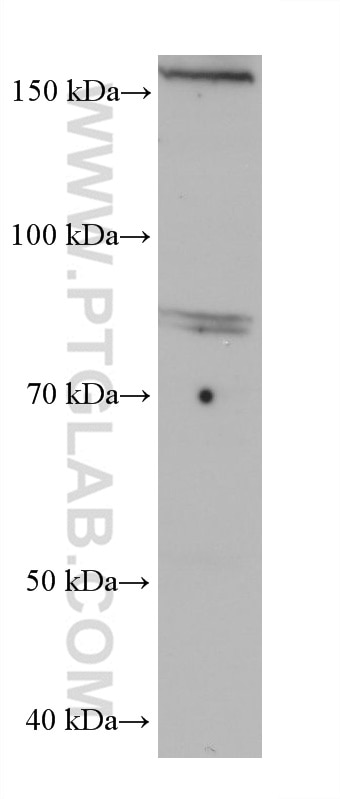 WB analysis of HaCaT using 68602-1-Ig