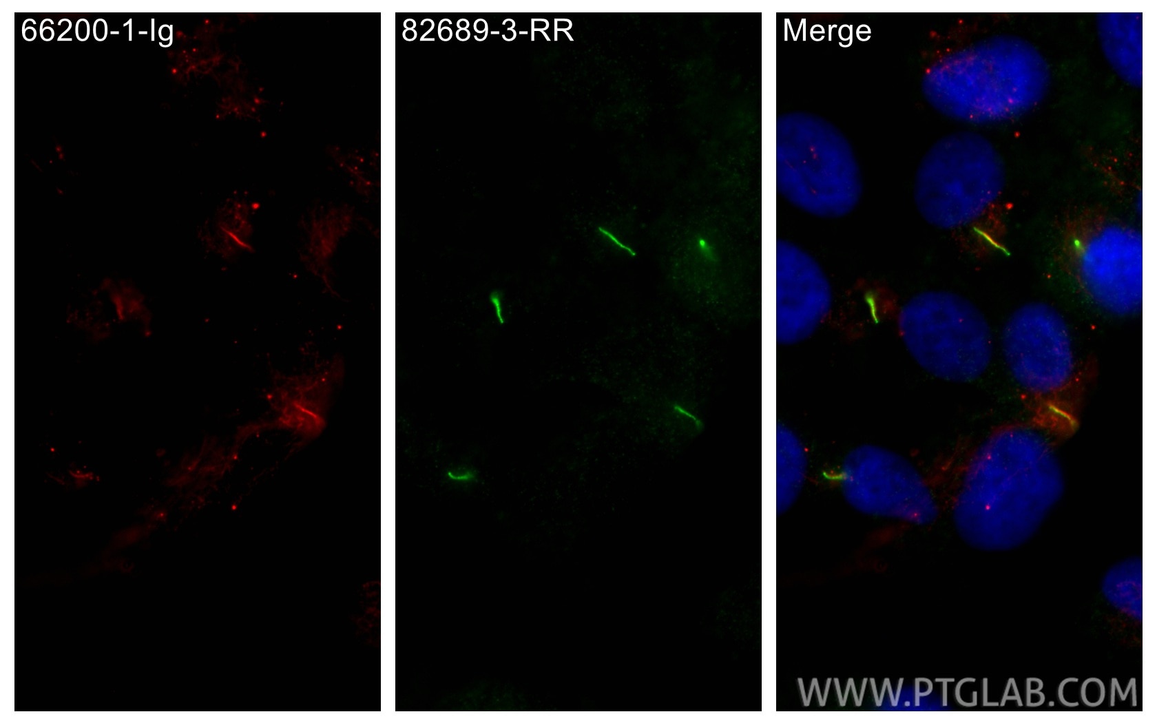 Immunofluorescence (IF) / fluorescent staining of hTERT-RPE1 cells using INPP5E Recombinant monoclonal antibody (82689-3-RR)