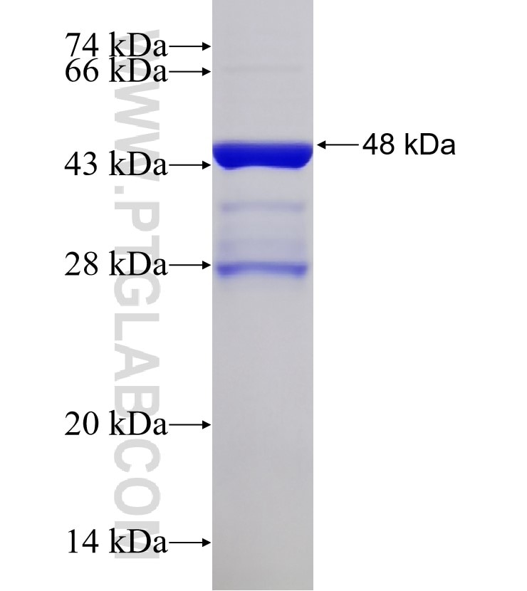INPP5E fusion protein Ag30305 SDS-PAGE