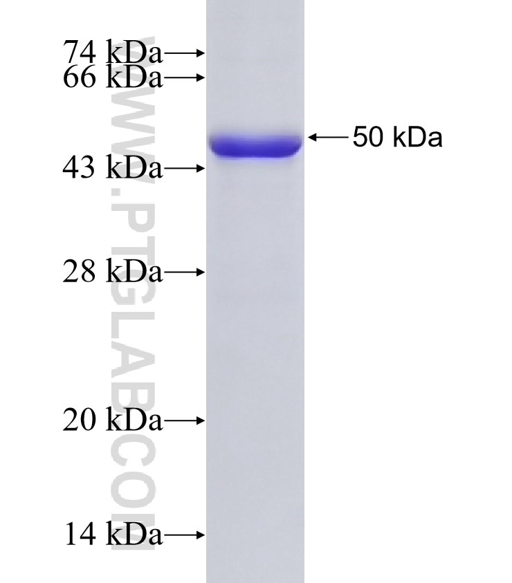 INPP5E fusion protein Ag32682 SDS-PAGE INPP5E fusion protein Ag32682 SDS-PAGE