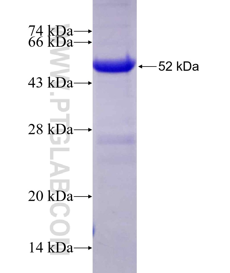 INPP5E fusion protein Ag11959 SDS-PAGE