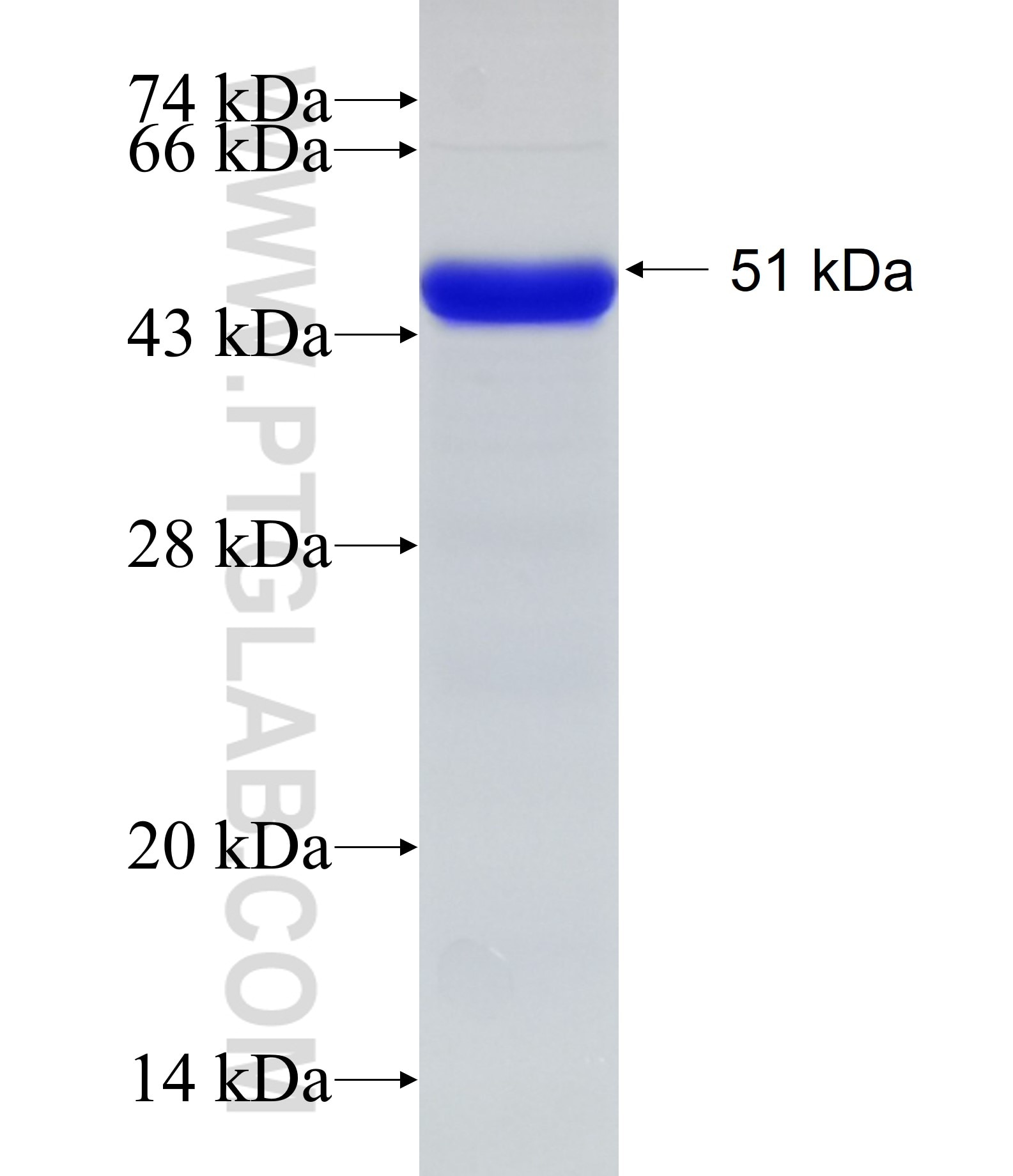 INPP5E fusion protein Ag11959 SDS-PAGE