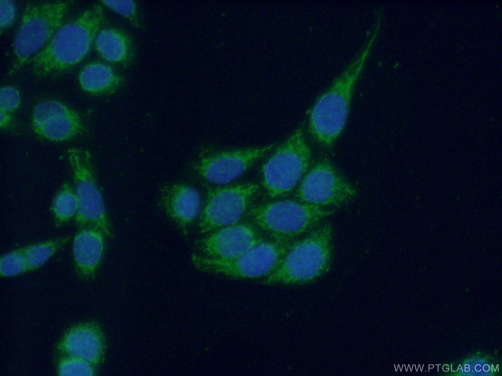Immunofluorescence (IF) / fluorescent staining of HeLa cells using INPP5J Polyclonal antibody (21417-1-AP)
