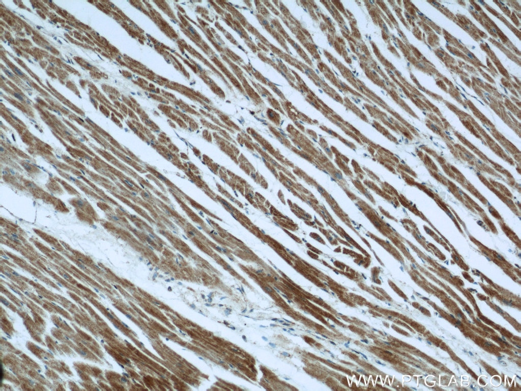 Immunohistochemistry (IHC) staining of human heart tissue using INPP5J Polyclonal antibody (21417-1-AP)