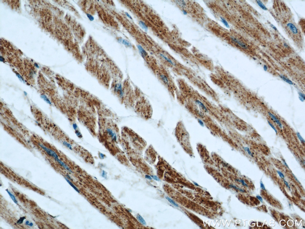 Immunohistochemistry (IHC) staining of human heart tissue using INPP5J Polyclonal antibody (21417-1-AP)