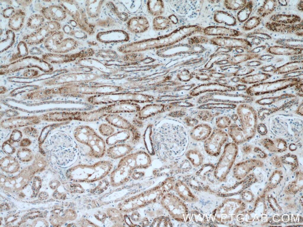 Immunohistochemistry (IHC) staining of human kidney tissue using INPP5J Polyclonal antibody (21417-1-AP)