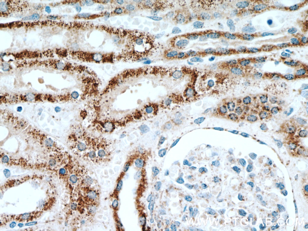 Immunohistochemistry (IHC) staining of human kidney tissue using INPP5J Polyclonal antibody (21417-1-AP)