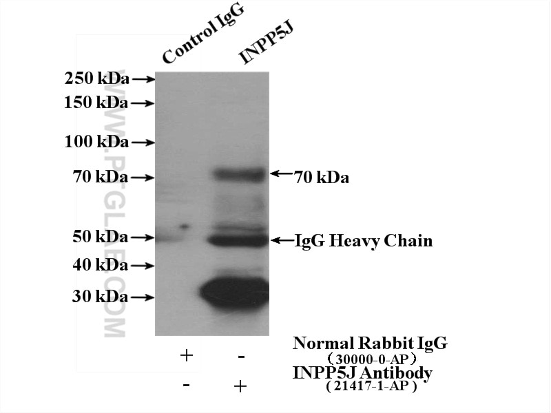 Immunoprecipitation (IP) experiment of mouse lung tissue using INPP5J Polyclonal antibody (21417-1-AP)