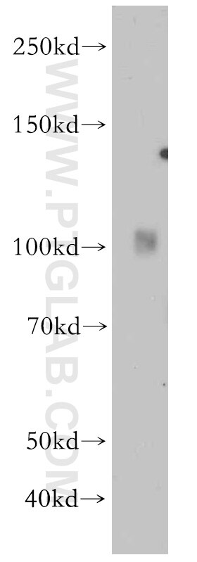 Western Blot (WB) analysis of human heart tissue using INPP5J Polyclonal antibody (21417-1-AP)