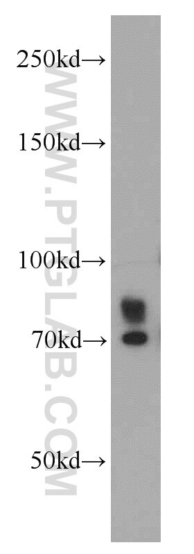 Western Blot (WB) analysis of mouse lung tissue using INPP5J Polyclonal antibody (21417-1-AP)