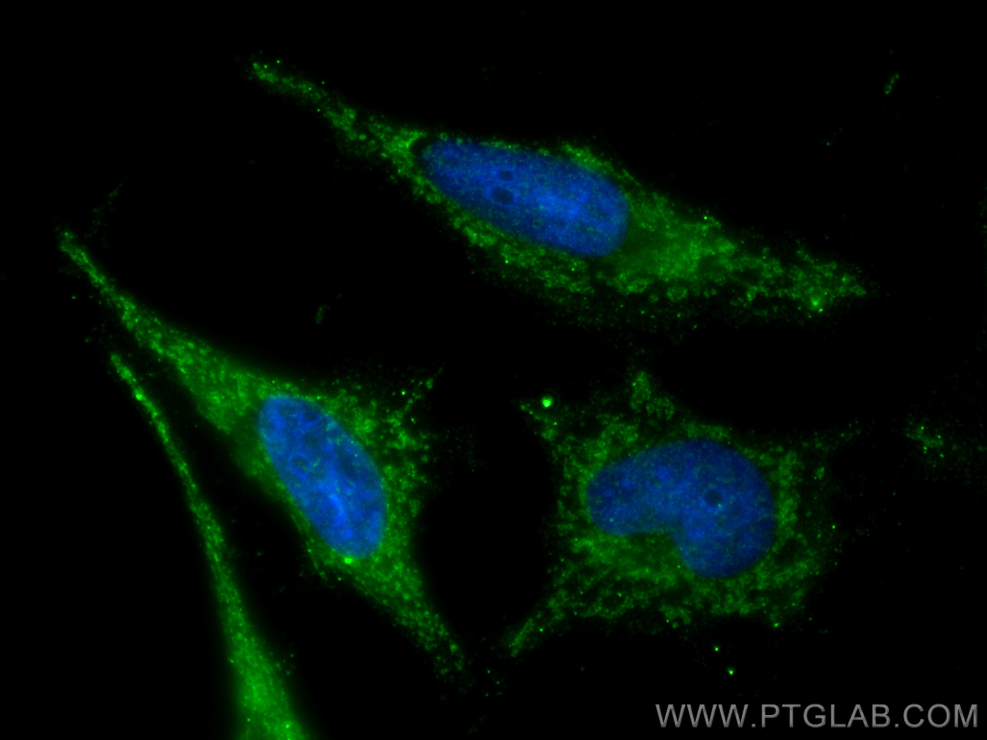 Immunofluorescence (IF) / fluorescent staining of HeLa cells using INPP5J Polyclonal antibody (29949-1-AP)