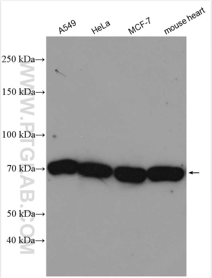 Western Blot (WB) analysis of various lysates using INPP5J Polyclonal antibody (29949-1-AP)