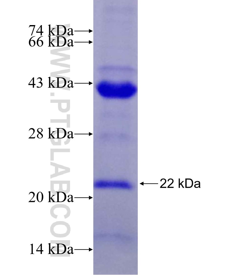 INPP5J fusion protein Ag29242 SDS-PAGE