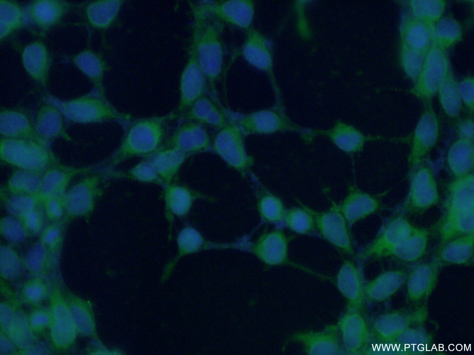 Immunofluorescence (IF) / fluorescent staining of HEK-293 cells using INPP5K Polyclonal antibody (15098-1-AP)