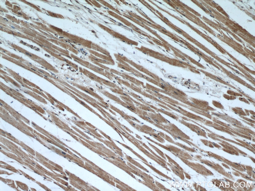 Immunohistochemistry (IHC) staining of human heart tissue using INPP5K Polyclonal antibody (15098-1-AP)