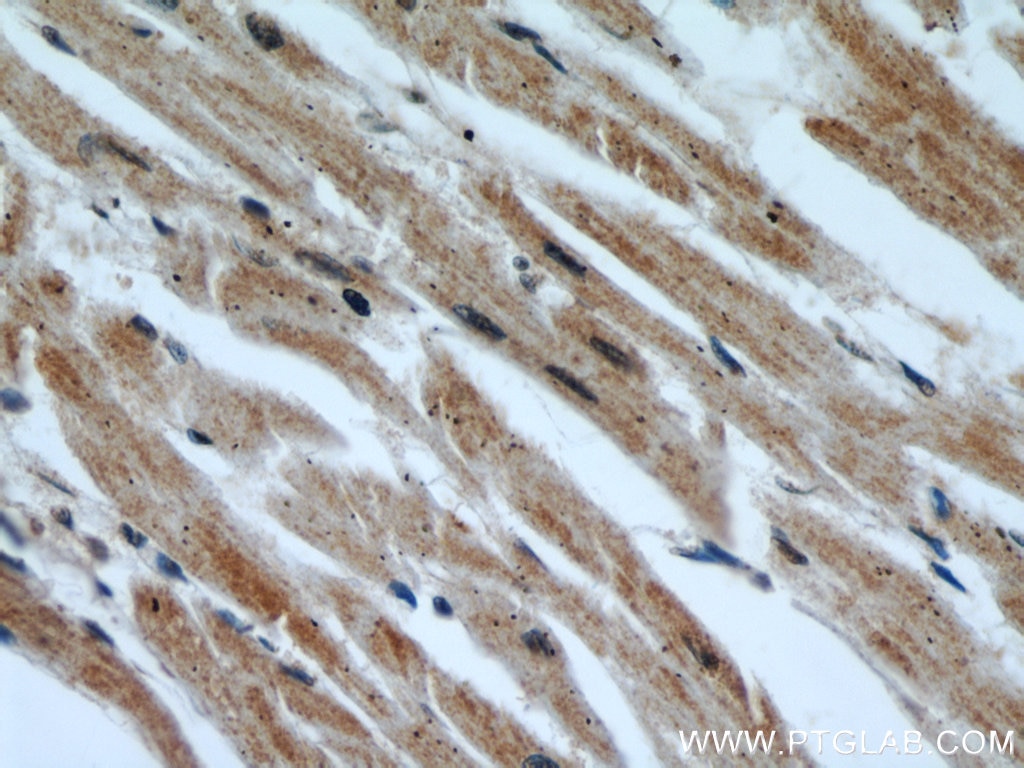 Immunohistochemistry (IHC) staining of human heart tissue using INPP5K Polyclonal antibody (15098-1-AP)