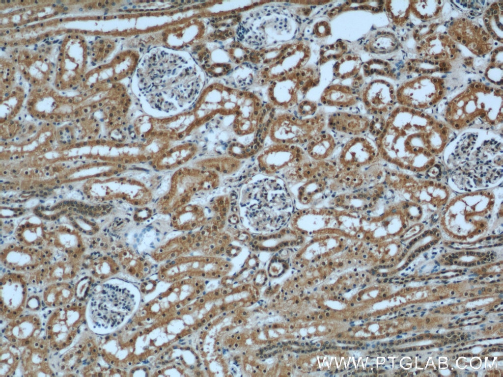 Immunohistochemistry (IHC) staining of human kidney tissue using INPP5K Polyclonal antibody (15098-1-AP)