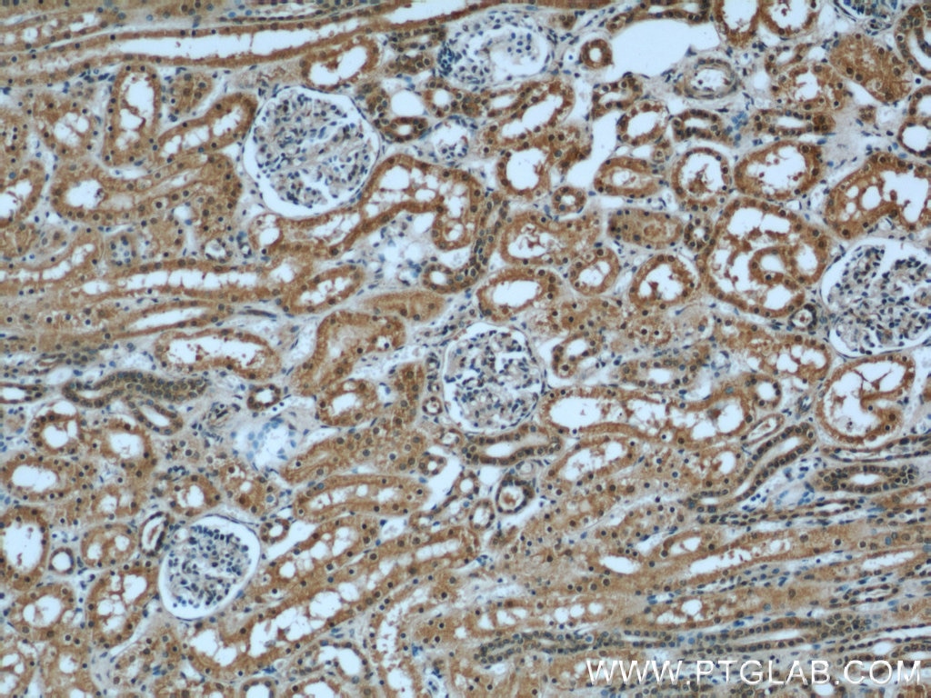 IHC staining of human kidney using 15098-1-AP