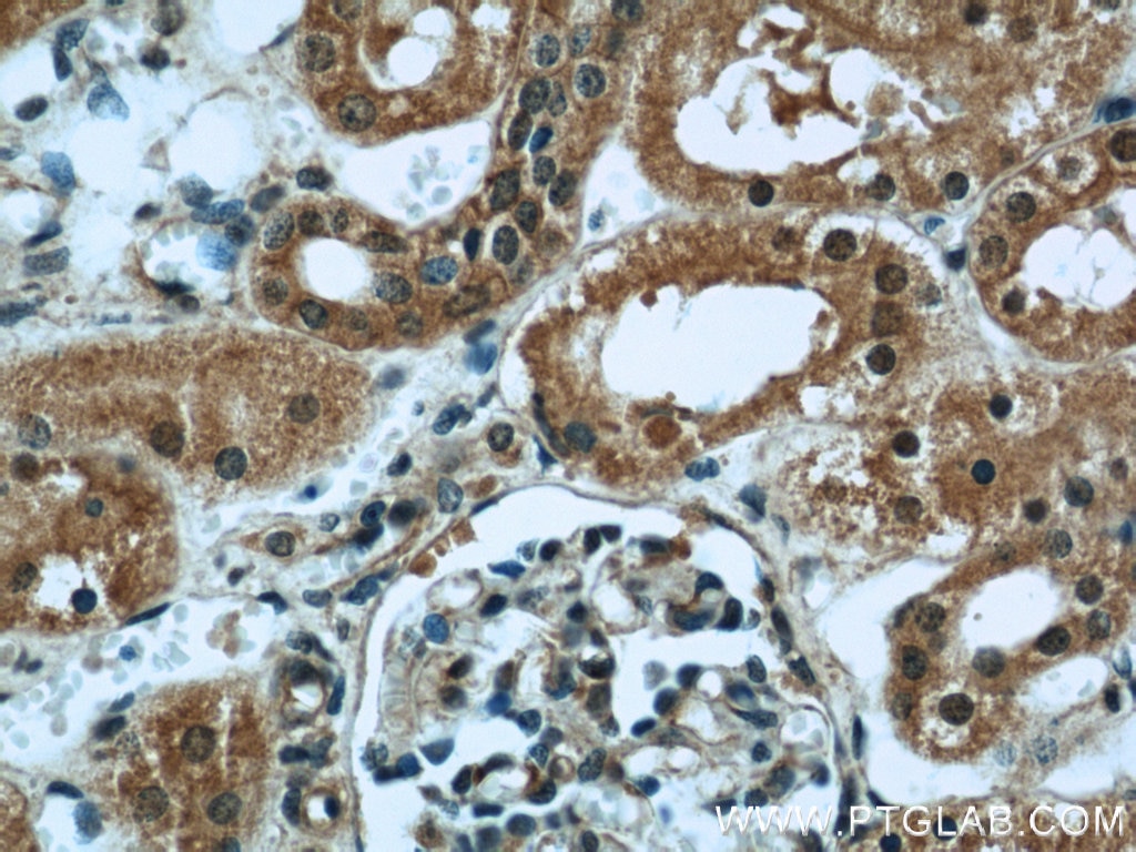 Immunohistochemistry (IHC) staining of human kidney tissue using INPP5K Polyclonal antibody (15098-1-AP)