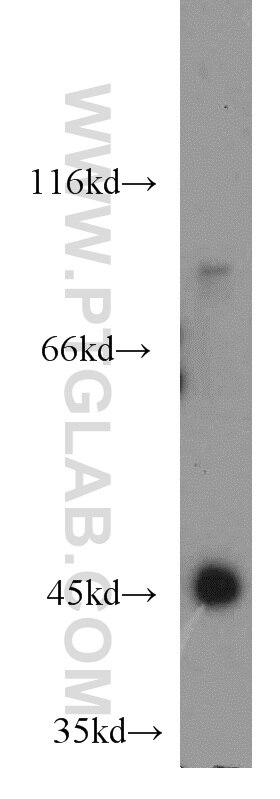 Western Blot (WB) analysis of mouse heart tissue using INPP5K Polyclonal antibody (15098-1-AP)