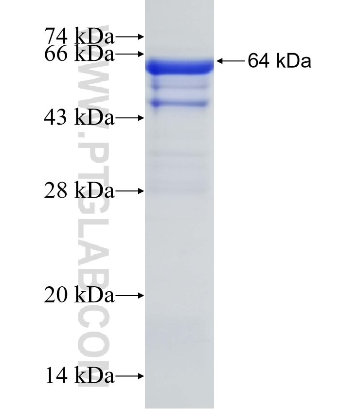 INPP5K fusion protein Ag7192 SDS-PAGE
