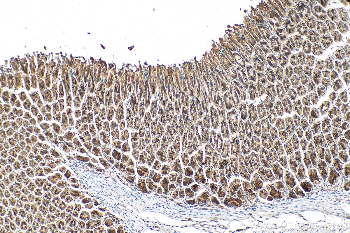 Immunohistochemistry (IHC) staining of mouse stomach tissue using INPPL1 Polyclonal antibody (26678-1-AP)