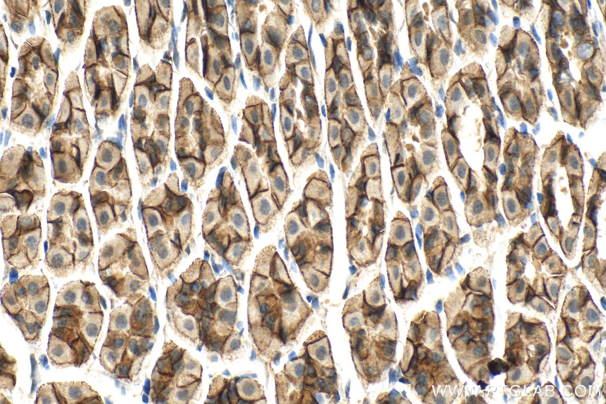Immunohistochemistry (IHC) staining of mouse stomach tissue using INPPL1 Polyclonal antibody (26678-1-AP)