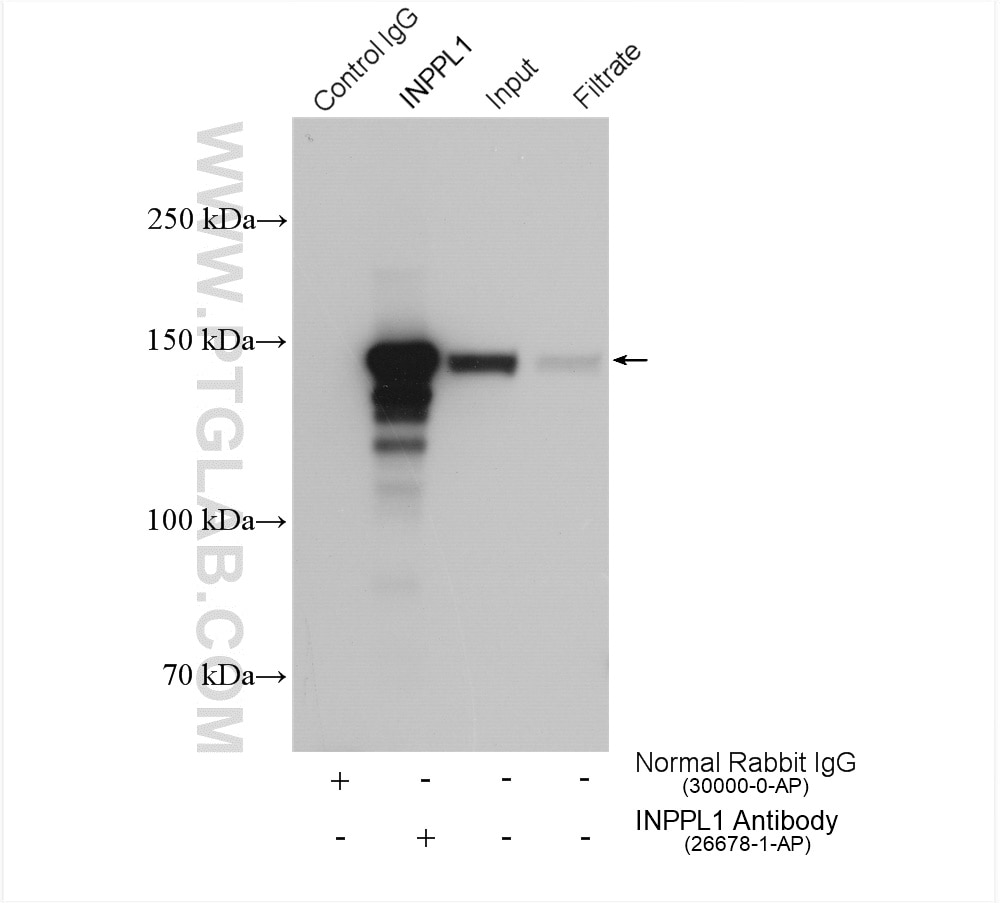 Immunoprecipitation (IP) experiment of HeLa cells using INPPL1 Polyclonal antibody (26678-1-AP)