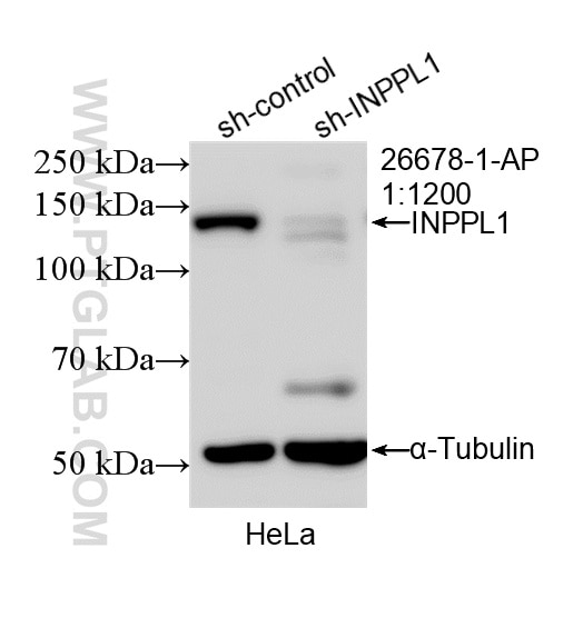 WB analysis of HeLa using 26678-1-AP Western Blot (WB) analysis of HeLa cells using INPPL1 Polyclonal antibody (26678-1-AP)
