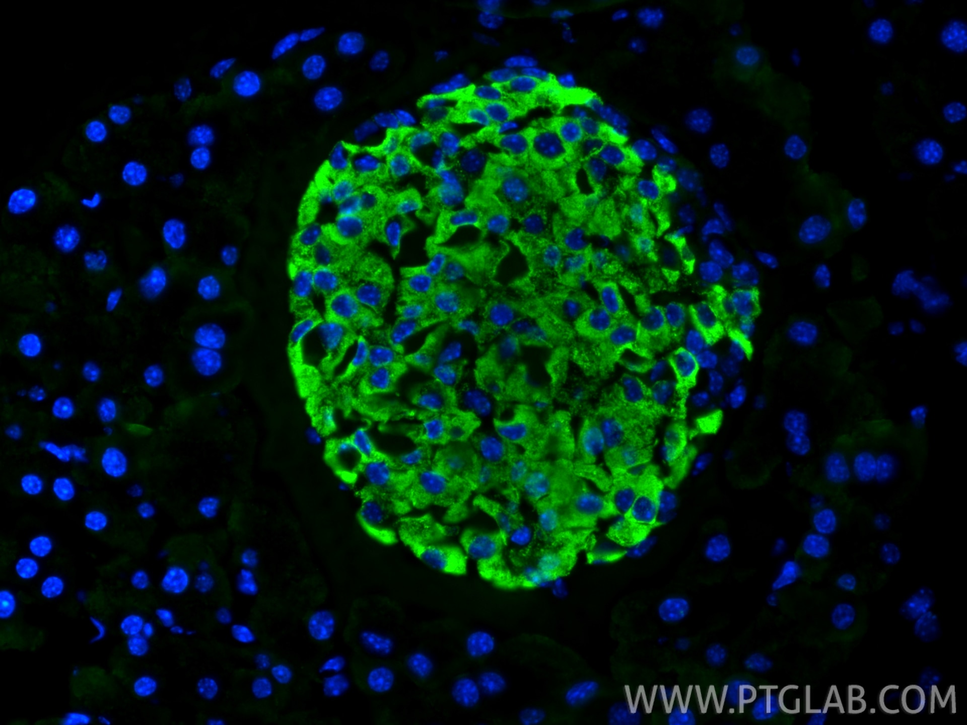 Immunofluorescence (IF) / fluorescent staining of mouse pancreas tissue using INS Polyclonal antibody (15848-1-AP)