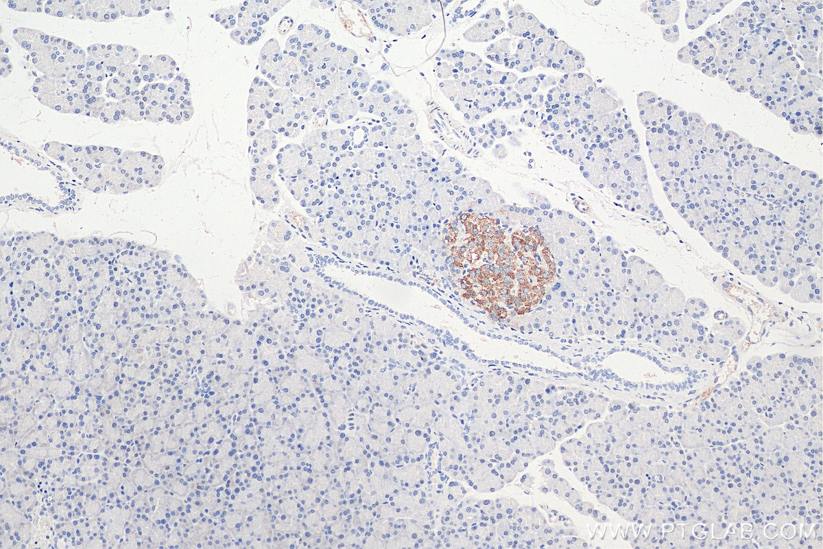 IHC staining of rat pancreas using 15848-1-AP